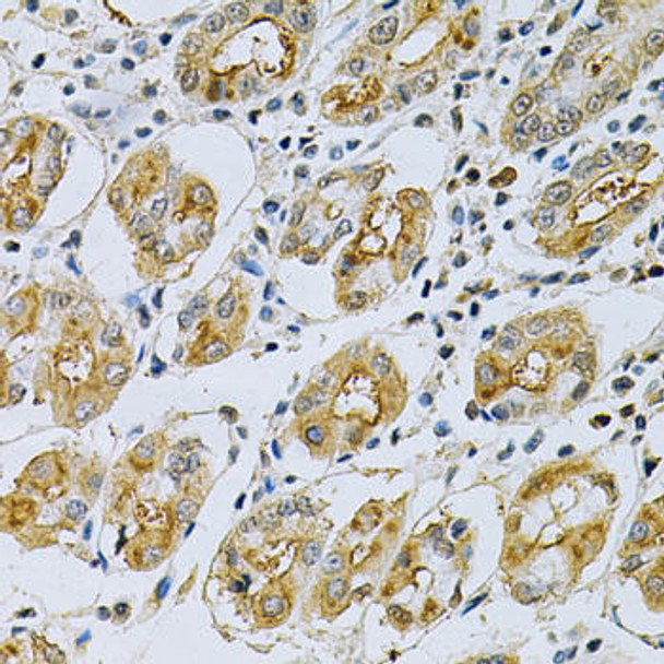 Cell Biology Antibodies 4 Anti-SERPINB5 Antibody CAB14042