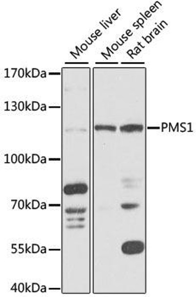 Epigenetics and Nuclear Signaling Antibodies 3 Anti-PMS1 Antibody CAB14046