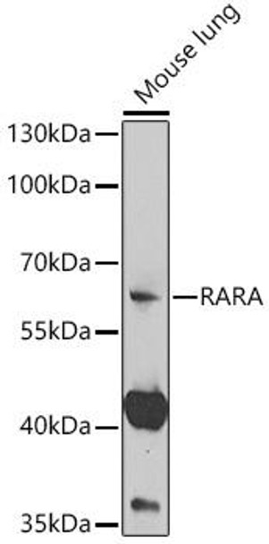 Epigenetics and Nuclear Signaling Antibodies 3 Anti-RARA Antibody CAB14057