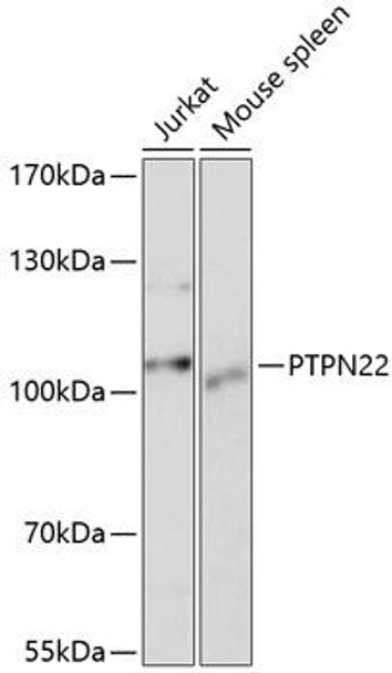 Autophagy Antibodies Anti-PTPN22 Antibody CAB1406