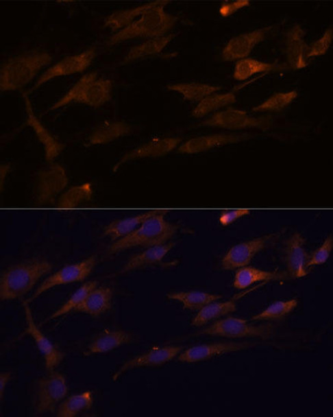 Cell Biology Antibodies 4 Anti-RPL7A Antibody CAB14060