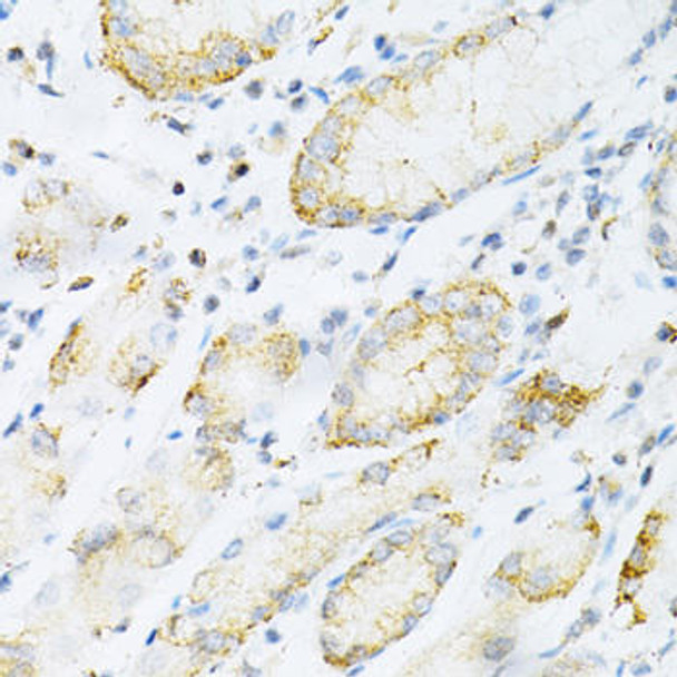 Metabolism Antibodies 1 Anti-SULT2A1 Antibody CAB14063