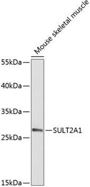 Metabolism Antibodies 1 Anti-SULT2A1 Antibody CAB14063