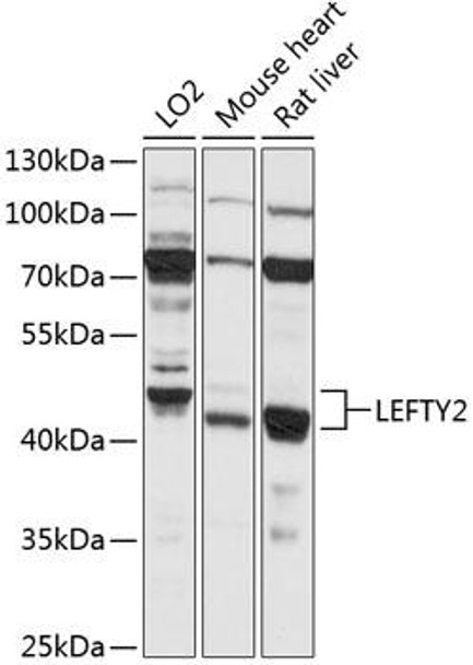 Cell Biology Antibodies 4 Anti-LEFTY2 Antibody CAB14065