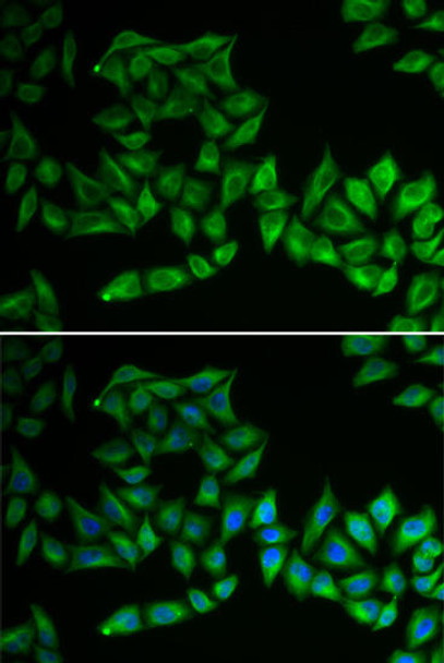 Cell Biology Antibodies 4 Anti-TPMT Antibody CAB14067