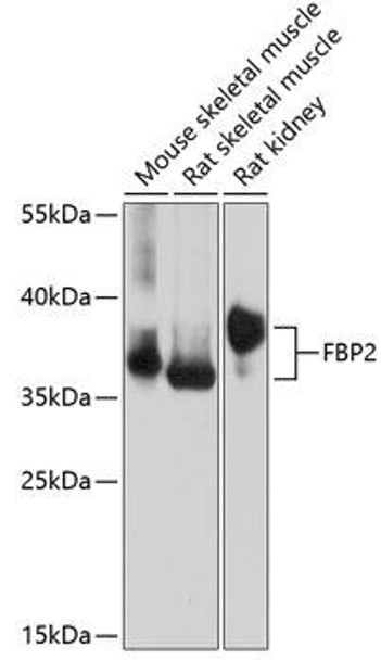 Metabolism Antibodies 1 Anti-FBP2 Antibody CAB14077