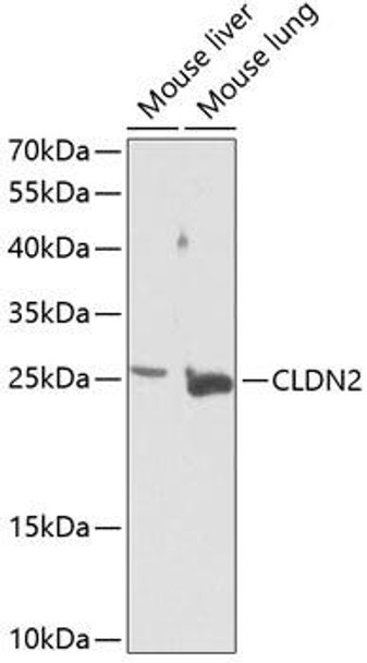 Cell Biology Antibodies 4 Anti-CLDN2 Antibody CAB14085