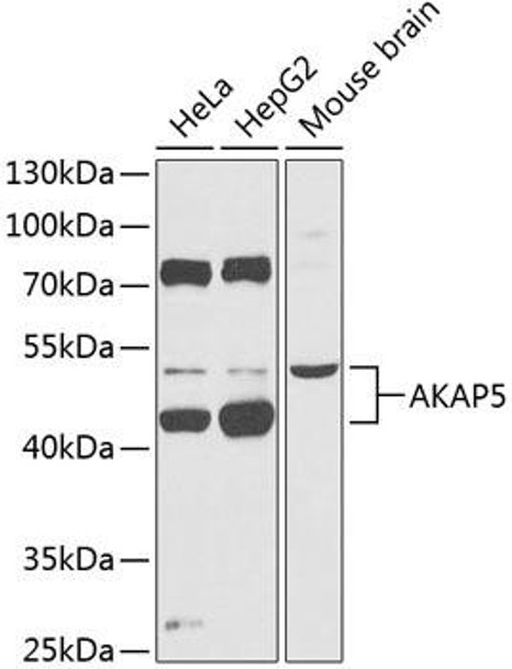 Cell Biology Antibodies 4 Anti-AKAP5 Antibody CAB14091