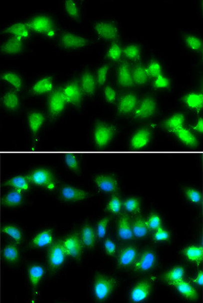 Cell Biology Antibodies 4 Anti-AKAP5 Antibody CAB14091