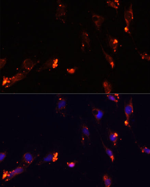 Epigenetics and Nuclear Signaling Antibodies 3 Anti-IKKEpsilon Antibody CAB14093