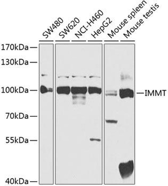 Cell Biology Antibodies 4 Anti-IMMT Antibody CAB14107