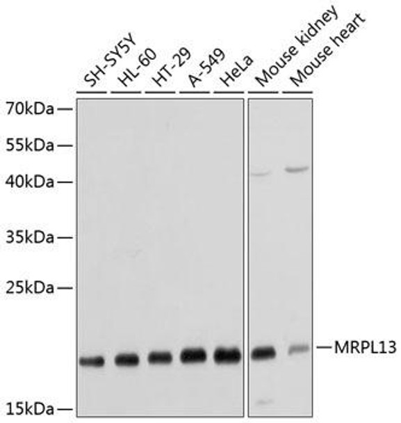 Cell Biology Antibodies 4 Anti-MRPL13 Antibody CAB14122