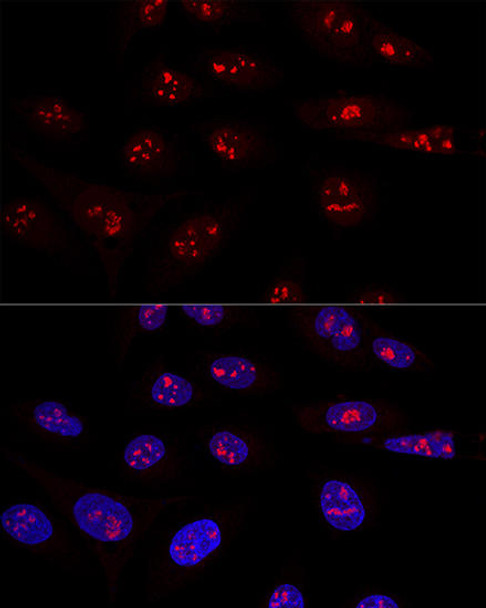Cell Biology Antibodies 4 Anti-NOP58 Antibody CAB14129