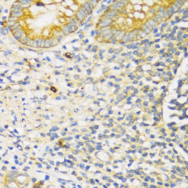 Cell Death Antibodies 1 Anti-TGFBR2 Antibody CAB1415