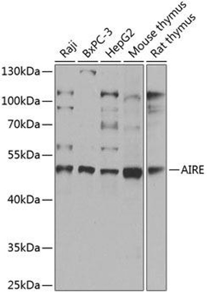 Epigenetics and Nuclear Signaling Antibodies 3 Anti-AIRE Antibody CAB14183