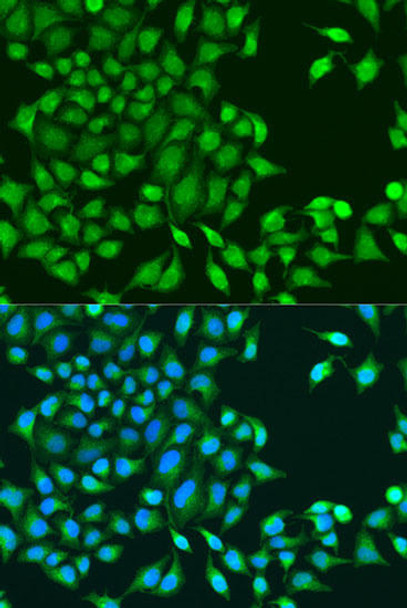 Cell Cycle Antibodies 1 Anti-RUVBL1 Antibody CAB14195