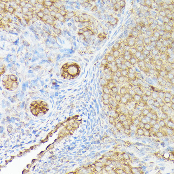 Cell Biology Antibodies 4 Anti-CX3CL1 Antibody CAB14198