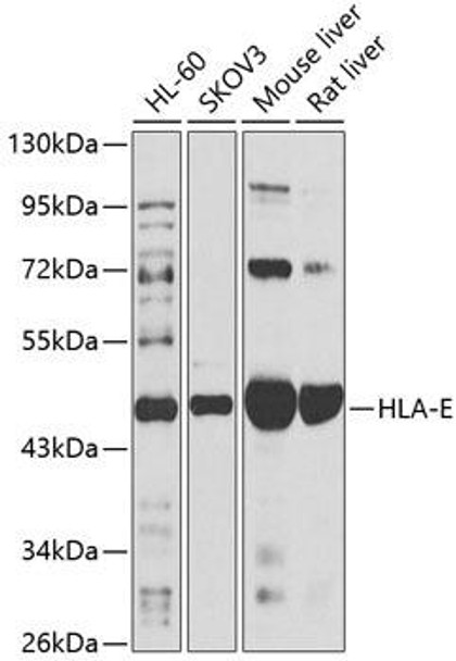 Immunology Antibodies 1 Anti-HLA-E Antibody CAB14206