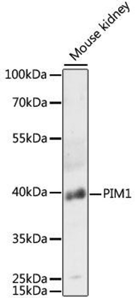 Cell Death Antibodies 1 Anti-PIM1 Antibody CAB14210