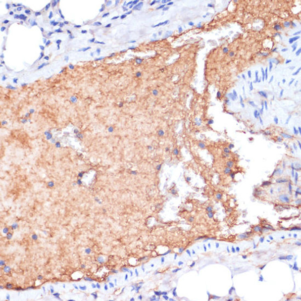 Metabolism Antibodies 1 Anti-APOA1 Antibody CAB14211