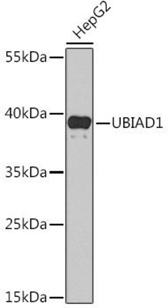 Metabolism Antibodies 1 Anti-UBIAD1 Antibody CAB14214