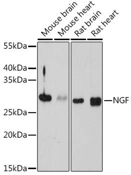 Cell Biology Antibodies 4 Anti-NGF Antibody CAB14216