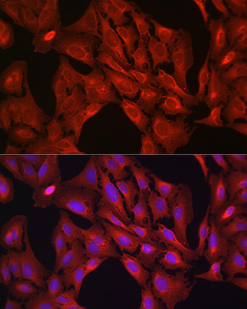 Cell Biology Antibodies 4 Anti-VASP Antibody CAB14217