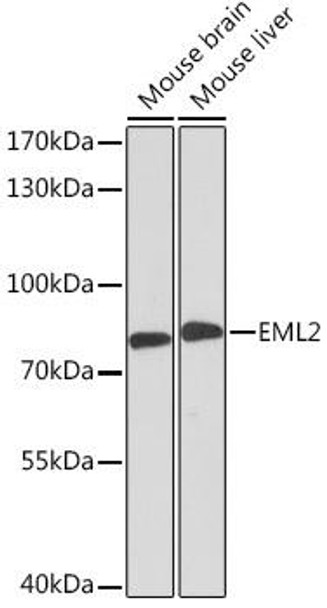 Cell Biology Antibodies 4 Anti-EML2 Antibody CAB14218