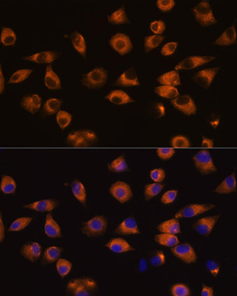 Neuroscience Anti-EPHA5 Antibody CAB14238