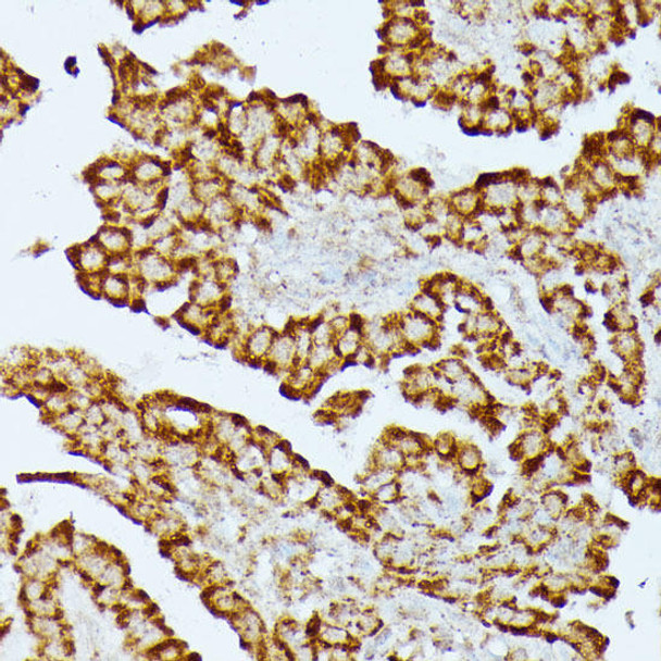 Metabolism Antibodies 1 Anti-HMGCS2 Antibody CAB14244