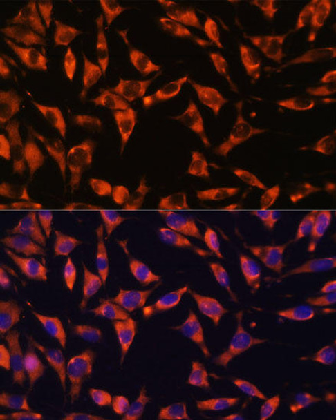 Signal Transduction Antibodies 1 Anti-JAG2 Antibody CAB14247