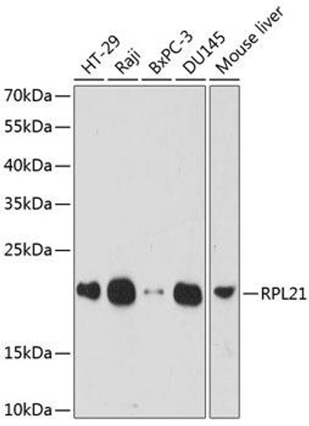 Cell Biology Antibodies 4 Anti-RPL21 Antibody CAB14254