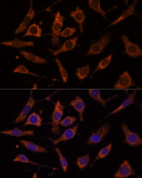 Cell Biology Antibodies 4 Anti-RPL24 Antibody CAB14255
