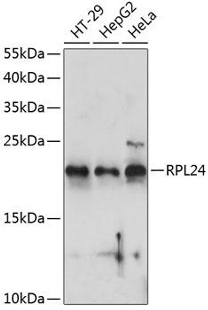 Cell Biology Antibodies 4 Anti-RPL24 Antibody CAB14255