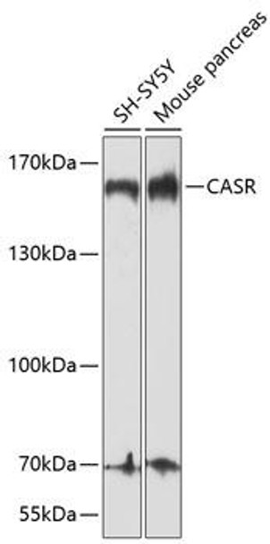 Metabolism Antibodies 1 Anti-CASR Antibody CAB1426