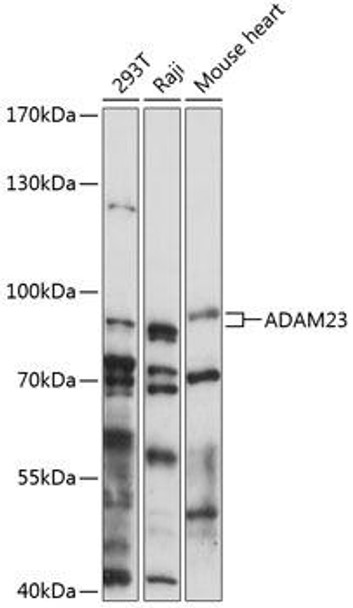 Cell Biology Antibodies 4 Anti-ADAM23 Antibody CAB14263