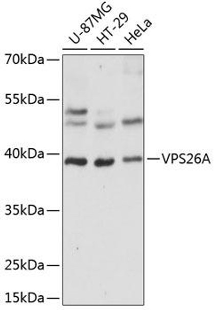 Cell Biology Antibodies 4 Anti-VPS26A Antibody CAB14265