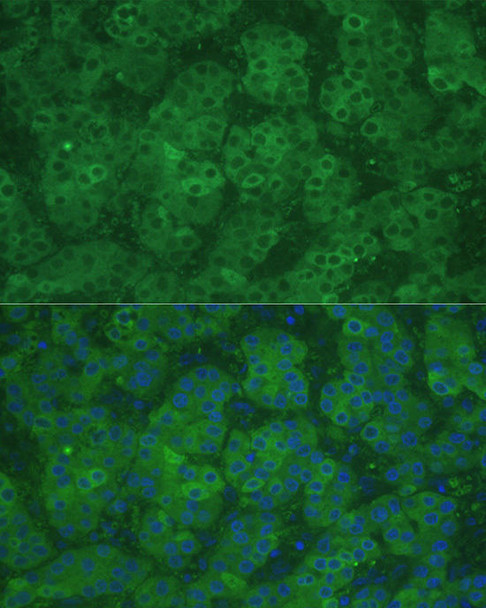 Metabolism Antibodies 1 Anti-CBS Antibody CAB1427