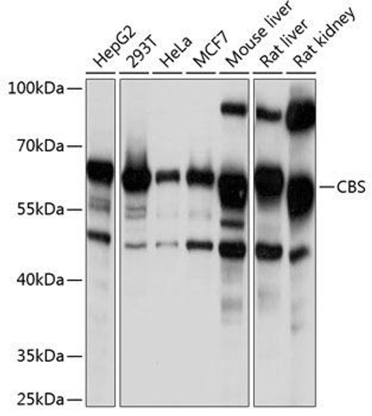 Metabolism Antibodies 1 Anti-CBS Antibody CAB1427