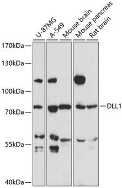 Developmental Biology Anti-DLL1 Antibody CAB14277