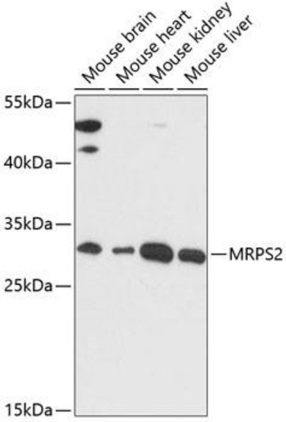 Epigenetics and Nuclear Signaling Antibodies 3 Anti-MRPS2 Antibody CAB14279