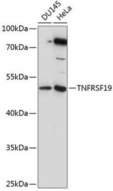 Cell Death Antibodies 1 Anti-TNFRSF19 Antibody CAB14284