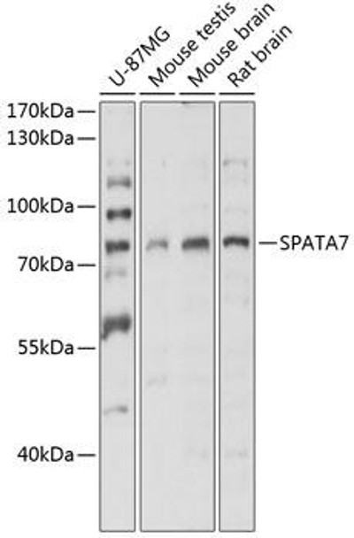 Signal Transduction Antibodies 1 Anti-SPATA7 Antibody CAB14285