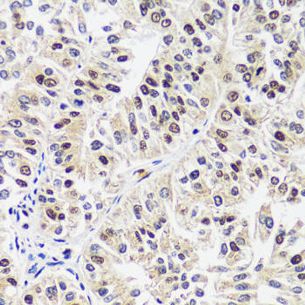 Signal Transduction Antibodies 1 Anti-CAND1 Antibody CAB14287