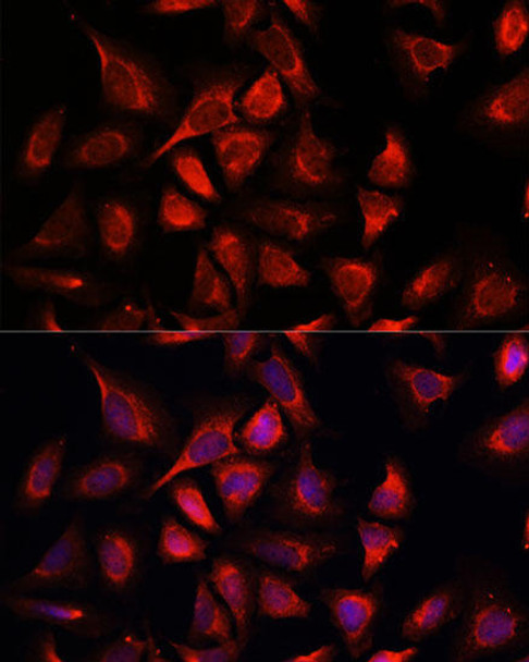 Cell Biology Antibodies 4 Anti-NDUFA4L2 Antibody CAB14288