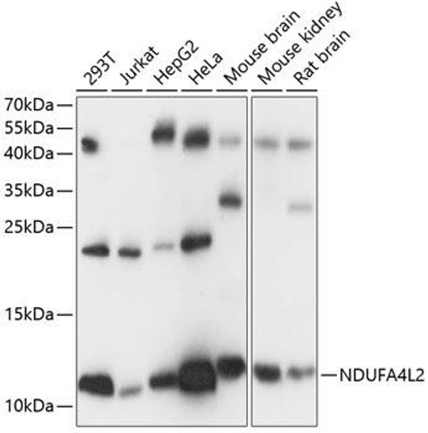 Cell Biology Antibodies 4 Anti-NDUFA4L2 Antibody CAB14288