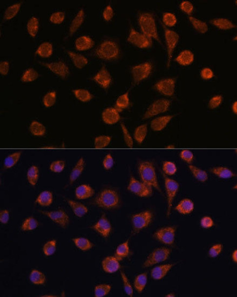 Cell Biology Antibodies 4 Anti-NDUFAF2 Antibody CAB14296