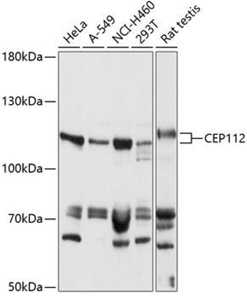 Cell Biology Antibodies 4 Anti-CEP112 Antibody CAB14302
