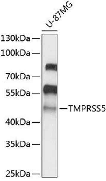 Cell Biology Antibodies 4 Anti-TMPRSS5 Antibody CAB14307