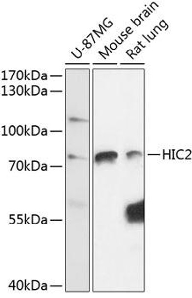 Epigenetics and Nuclear Signaling Antibodies 3 Anti-HIC2 Antibody CAB14313